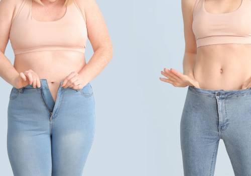 Understanding Gastric Bypass Surgery for Weight Loss