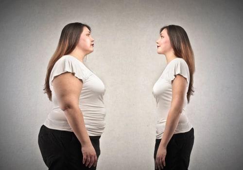 All You Need to Know About Consulting with a Surgeon for Weight Loss